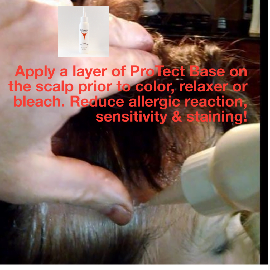 hair dye allergy, allergic reaction to hair dye