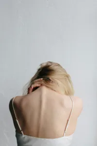 psoriasis hair loss